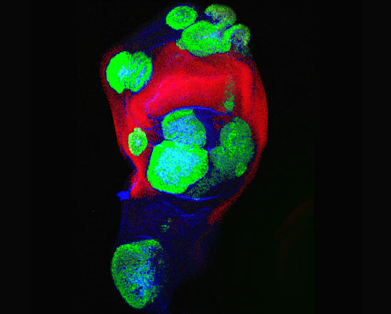 A fruit fly epithelial cell sheet displaying cancerous growth