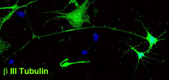 Neuron-like cell from mBMSCs